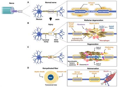Neuron-Schwann cell interactions in peripheral nervous system homeostasis, disease, and preclinical treatment
